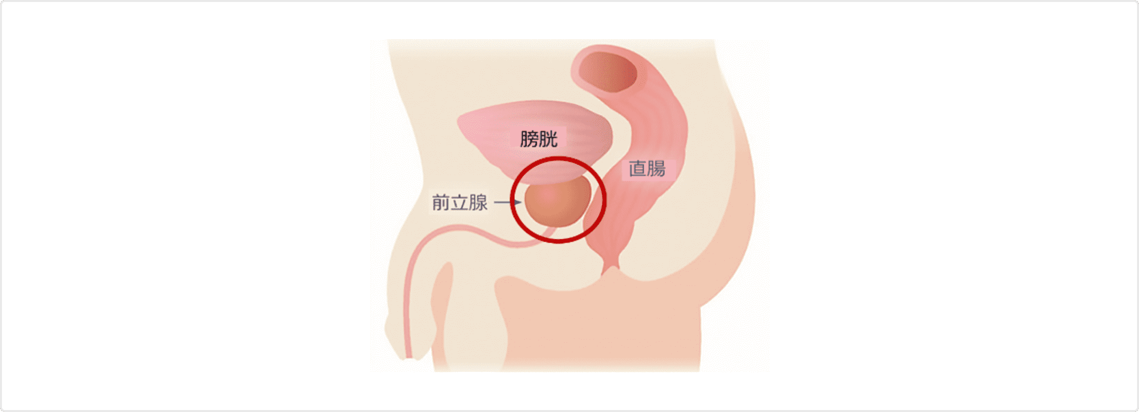 前立腺(下腹部矢状断面)