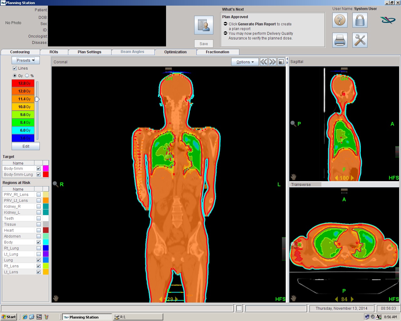 トモ恐怖症の原因は何ですか?